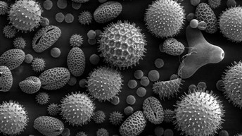 Figure 9:Pollen Grains